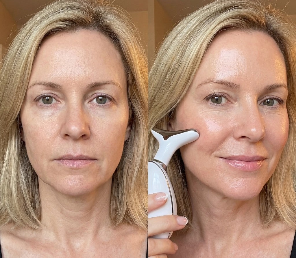 SH&RO Skin Facial Massager