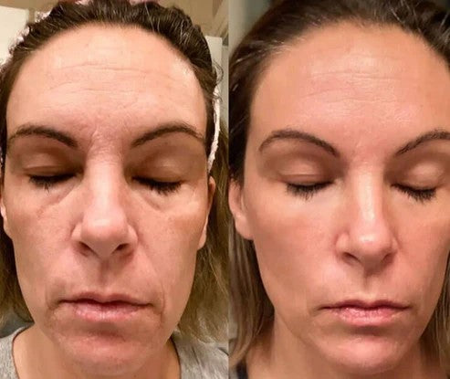 SH&RO Skin Facial Massager