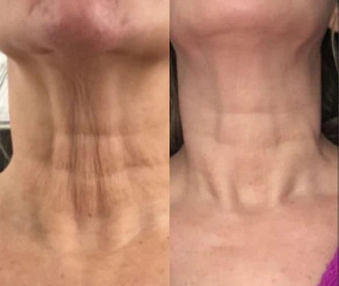 SH&RO Skin Facial Massager