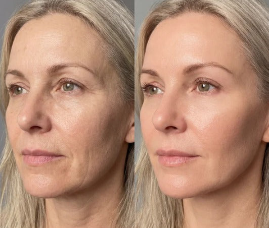 SH&RO Skin Facial Massager